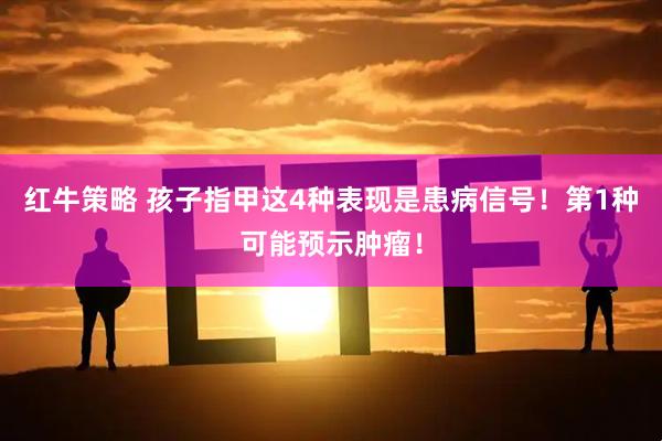 红牛策略 孩子指甲这4种表现是患病信号！第1种可能预示肿瘤！